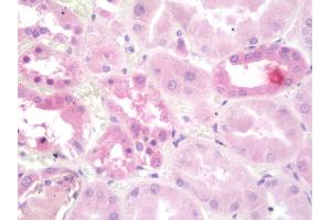 Immunohistochemistry (IHC) image for anti-ATPase, H+ Transporting, Lysosomal Accessory Protein 2 (ATP6AP2) (AA 205-234) antibody (ABIN1976867)