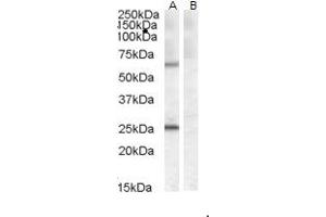 Western Blotting (WB) image for anti-Collagen, Type IV, alpha 3 (Goodpasture Antigen) Binding Protein (COL4A3BP) (AA 662-672) antibody (ABIN238598)