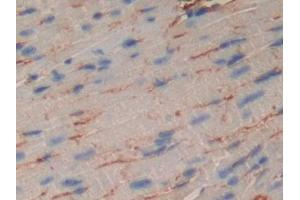 Detection of MUSK in Mouse Heart Tissue using Polyclonal Antibody to Muscle, Skeletal, Receptor Tyrosine Kinase (MUSK)