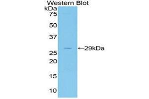 Western Blotting (WB) image for anti-Jagged 2 (JAG2) (AA 709-941) antibody (ABIN1859519) (JAG2 抗体  (AA 709-941))