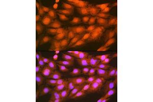 Immunofluorescence (IF) image for anti-Proteasome (Prosome, Macropain) 26S Subunit, Non-ATPase, 14 (PSMD14) antibody (ABIN7269588)