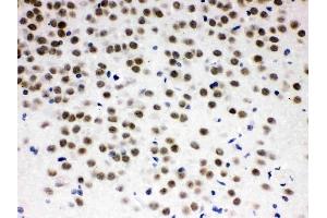 IHC analysis of ZBTB7A using anti-ZBTB7A antibody (ABIN3044569).