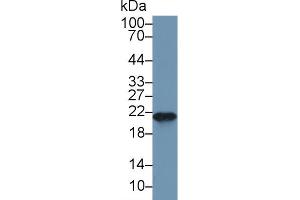Western blot analysis of Mouse Spleen lysate, using Mouse FTH Antibody (1 µg/ml) and HRP-conjugated Goat Anti-Rabbit antibody ( (FTH1 抗体  (AA 1-182))