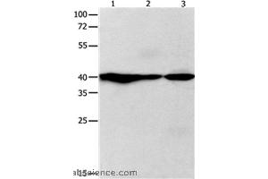 Western blot analysis of Human fetal brain and brain malignant glioma, mouse brain tissue, using GNAZ Polyclonal Antibody at dilution of 1:400 (GNaZ 抗体)