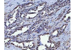 IHC analysis of KAP1 using anti-KAP1 antibody (ABIN3043491).