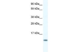WB Suggested Anti-FXYD5 Antibody Titration:  0. (FXYD5 抗体  (N-Term))