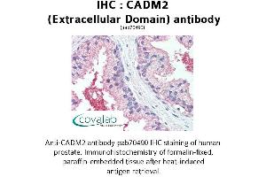 Image no. 1 for anti-Cell Adhesion Molecule 2 (CADM2) (Extracellular Domain) antibody (ABIN1732535) (CADM2 抗体  (Extracellular Domain))