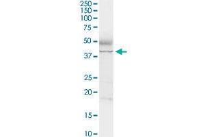 ADA MaxPab rabbit polyclonal antibody. (ADA 抗体  (AA 1-363))