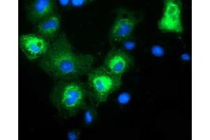 Anti-MAPK7 mouse monoclonal antibody (ABIN2454054) immunofluorescent staining of COS7 cells transiently transfected by pCMV6-ENTRY MAPK7 (RC203506). (MAPK7 抗体)