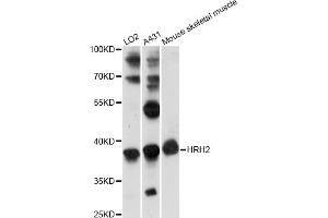 Western blot analysis of extracts of various cell lines, using HRH2 antibody (ABIN6290488) at 1:1000 dilution. (HRH2 抗体)
