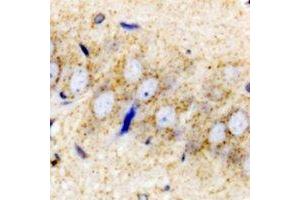 Immunohistochemistry (IHC) image for anti-Proenkephalin (PENK) antibody (ABIN7308156) (Enkephalin 抗体)