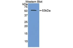 Detection of Recombinant PSMC2, Human using Polyclonal Antibody to Proteasome 26S Subunit, ATPase 2 (PSMC2) (PSMC2 抗体  (AA 1-433))