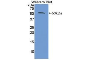Western Blotting (WB) image for anti-Proteasome (Prosome, Macropain) 26S Subunit, ATPase, 2 (PSMC2) (AA 1-433) antibody (ABIN7442063)