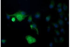 Image no. 5 for anti-Differentially Expressed in FDCP 6 Homolog (DEF6) antibody (ABIN1497808)