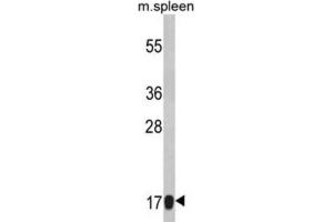 Western Blotting (WB) image for anti-Ribosomal Protein S18 (RPS18) antibody (ABIN3002859) (RPS18 抗体)