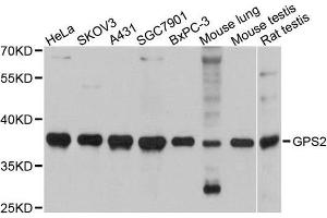 Western blot analysis of extracts of various cell lines, using GPS2 antibody. (GPS2 抗体)