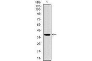 Western Blotting (WB) image for anti-Forkhead Box O1 (FOXO1) antibody (ABIN1107270) (FOXO1 抗体)