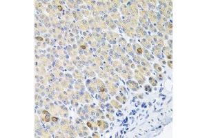 Immunohistochemistry of paraffin-embedded mouse stomach using GLS antibody. (Glutaminase 抗体  (AA 610-669))