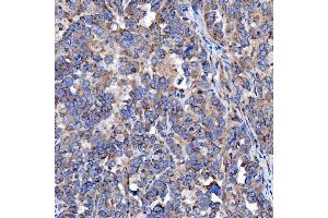 IHC analysis of TTC7B using anti-TTC7B antibody (ABIN7601050). (TTC7B 抗体  (AA 275-730))