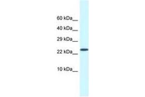 Image no. 1 for anti-Cold Shock Domain Containing C2, RNA Binding (CSDC2) (AA 21-70) antibody (ABIN6747761) (CSDC2 抗体  (AA 21-70))