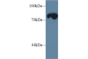 Western Blotting (WB) image for anti-Triadin (TRDN) (AA 486-687) antibody (ABIN7444922)