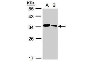 WB Image Sample(30 ug whole cell lysate) A:293T B:Raji , 12% SDS PAGE antibody diluted at 1:1000 (MMACHC 抗体  (Center))