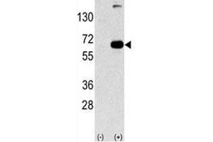 Western Blotting (WB) image for anti-Sequestosome 1 (SQSTM1) (AA 317-346) antibody (ABIN3031543)
