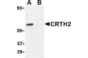 Western blot analysis of CRTH2 in Jurkat cell lysate with CRTH2 antibody at 1 μg/ml in (A) the absence and (B) presence of blocking peptide. (Prostaglandin D2 Receptor 2 (PTGDR2) (N-Term) 抗体)