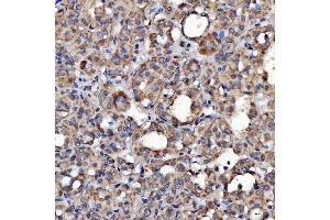 IHC analysis of SARS2 using anti-SARS2 antibody (ABIN7601804). (SARS2 抗体  (AA 46-518))