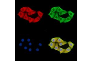 ABIN7095870 and ABIN7099932 staining Hela cells by IF/ICC. (PARP16 抗体)