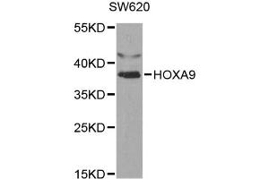 Western blot analysis of extracts of SW620 cells, using HOXA9 antibody (ABIN5970979) at 1/1000 dilution. (HOXA9 抗体)