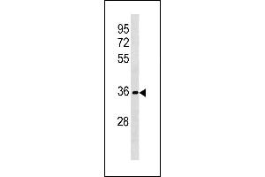 RFPL3 Antibody (N-term) (ABIN1881745 and ABIN2843224) western blot analysis in HL-60 cell line lysates (35 μg/lane). (RFPL3 抗体  (N-Term))