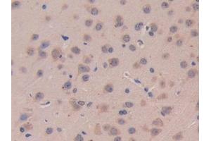 Detection of IL11Ra in Mouse Cerebrum Tissue using Polyclonal Antibody to Interleukin 11 Receptor Alpha (IL11Ra)