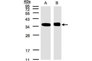 WB Image Sample(30 μg of whole cell lysate) A:293T B:Raji, 12% SDS PAGE antibody diluted at 1:500 (NMI 抗体)