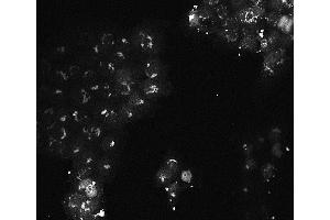 Immunofluorescence of Mouse monoclonal anti-AKT3 antibody Cell Type: A431 cells Fixation: 4% paraformaldehyde 10 min Permeablization: 0. (AKT3 抗体  (Internal Region))