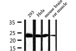 Western blot analysis of extracts from 293,Hela,mouse brain and rat muscle, using TPT1 Antibody. (TPT1 抗体  (Internal Region))