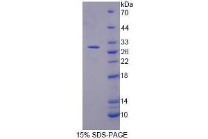 SDS-PAGE analysis of Human Mucin 17 Protein. (MUC17 蛋白)