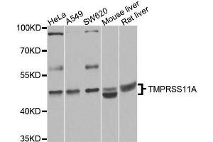 Western blot analysis of extracts of various cell lines, using TMPRSS11A antibody. (TMPRSS11A 抗体)