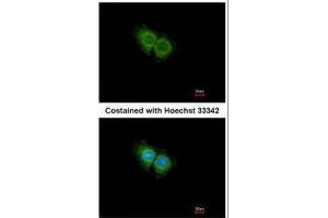 ICC/IF Image Immunofluorescence analysis of methanol-fixed Hep G2, using CXCR1, antibody at 1:500 dilution. (CXCR1 抗体  (C-Term))