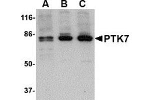 Western Blotting (WB) image for anti-PTK7 Protein tyrosine Kinase 7 (PTK7) (N-Term) antibody (ABIN1031528) (PTK7 抗体  (N-Term))