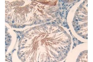 Immunohistochemistry (IHC) image for anti-Serpin Family A Member 7 (SERPINA7) (AA 114-391) antibody (ABIN7429169)