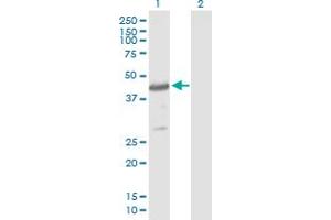 Western Blot analysis of CYTH4 expression in transfected 293T cell line by CYTH4 MaxPab polyclonal antibody. (Cytohesin 4 抗体  (AA 1-394))