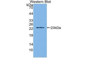 Western Blotting (WB) image for anti-Tryptophanyl-tRNA Synthetase (WARS) (AA 29-195) antibody (ABIN1860958) (WARS 抗体  (AA 29-195))