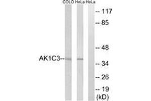 Western blot analysis of extracts from HeLa/COLO cells, using AKR1C3 Antibody. (AKR1C3 抗体  (AA 191-240))