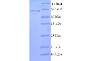 SDS-PAGE (SDS) image for SWI/SNF Related, Matrix Associated, Actin Dependent Regulator of Chromatin, Subfamily A, Member 2 (SMARCA2) (AA 700-1216), (partial) protein (His tag) (ABIN5713844) (SMARCA2 Protein (AA 700-1216, partial) (His tag))