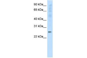 WB Suggested Anti-SNAP25 Antibody Titration:  0. (SNAP25 抗体  (C-Term))