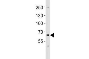 Western Blotting (WB) image for anti-Proprotein Convertase Subtilisin/kexin Type 9 (PCSK9) (C-Term) antibody (ABIN3032340)