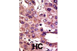 Immunohistochemistry (IHC) image for anti-Autocrine Motility Factor Receptor (AMFR) antibody (ABIN2995186) (AMFR 抗体)