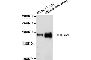 Western blot analysis of extracts of various cell lines, using COL3A1 antibody (ABIN5971985) at 1/1000 dilution. (COL3A1 抗体)