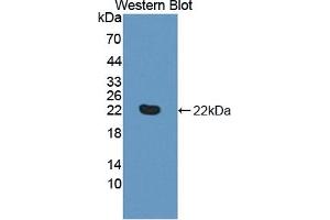 Detection of Recombinant TNFRSF14, Human using Polyclonal Antibody to Tumor Necrosis Factor Receptor Superfamily, Member 14 (TNFRSF14) (HVEM 抗体  (AA 41-209))